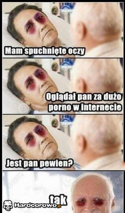 Spuchnięte oczy  - 1