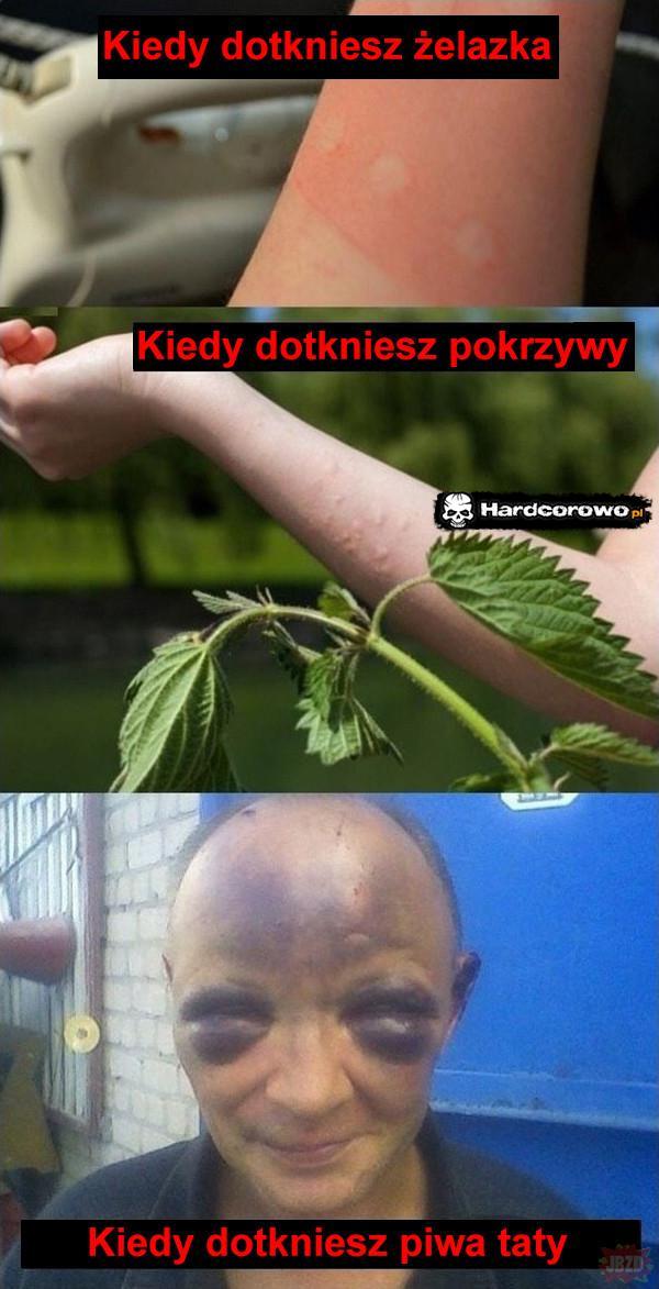  - 1