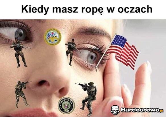 Ropa w oczach - 1