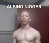 Albino Nigger