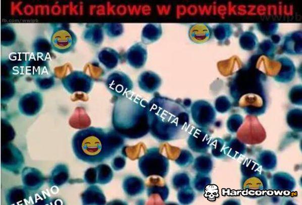 Komórki rakowe - 1