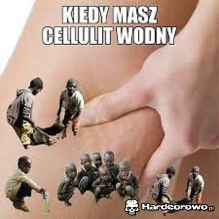 Cellulit wodny - 1