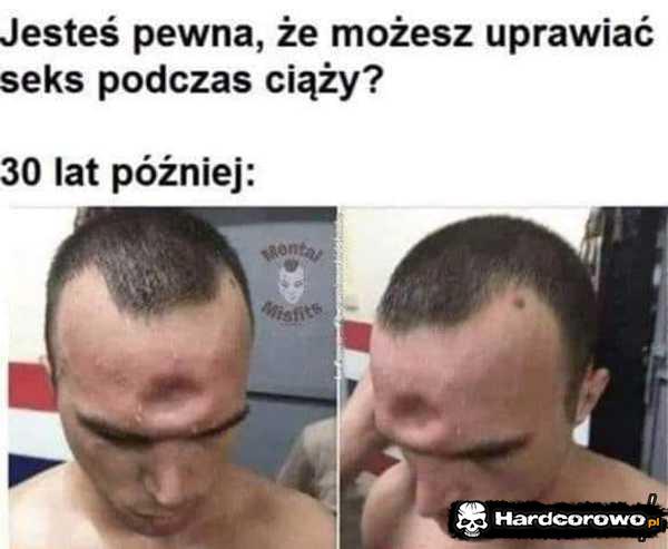  - 1