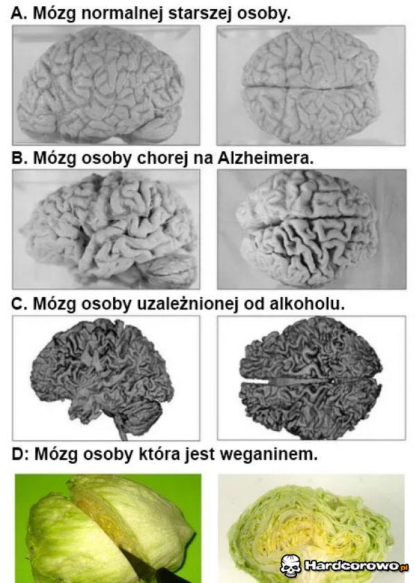 Mózgi - 1
