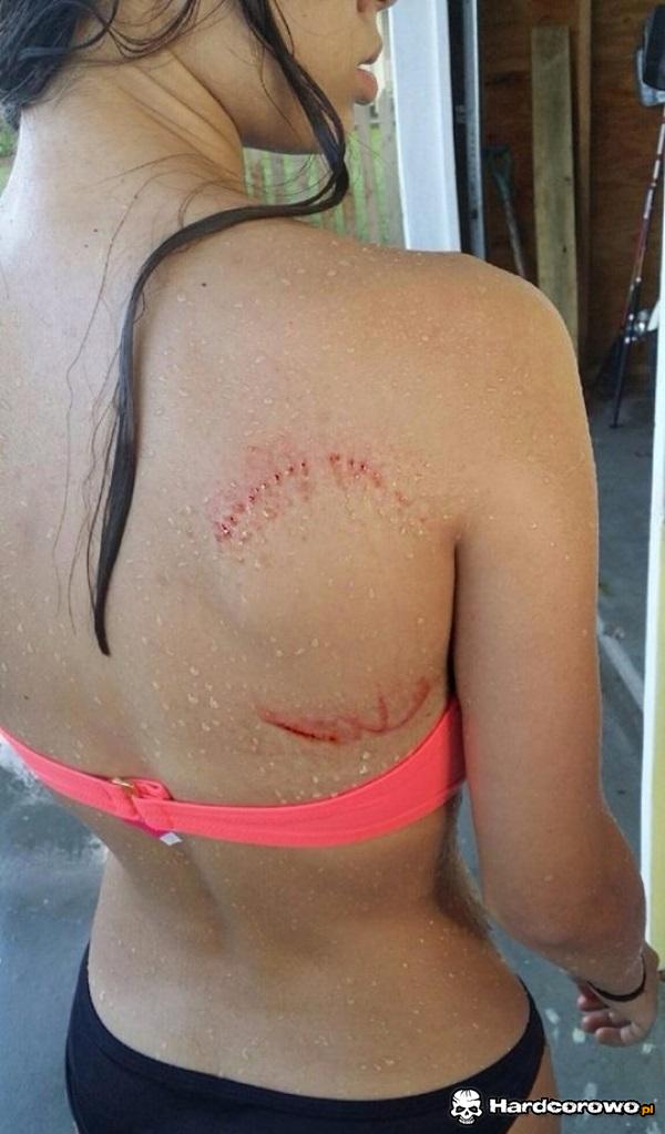 Ugryzienie rekina - 1