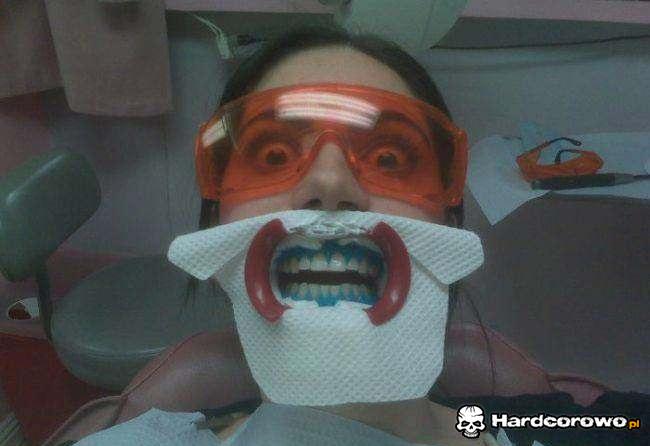 U dentysty  - 1