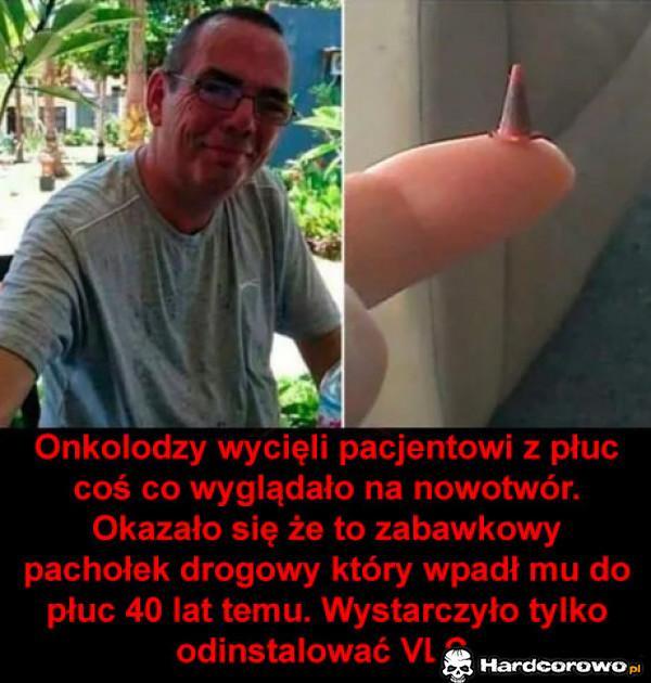  - 1