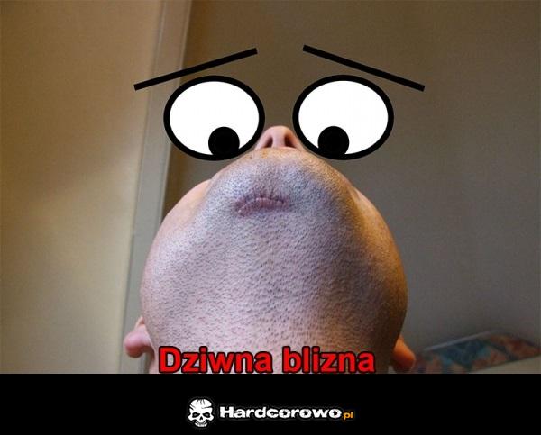 Blizna - 1