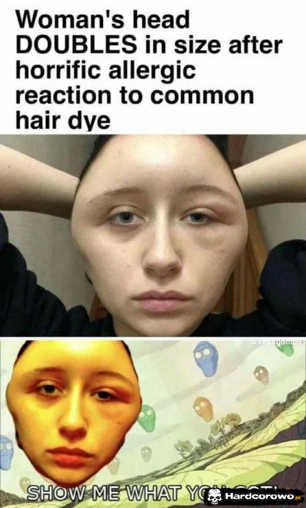  - 1