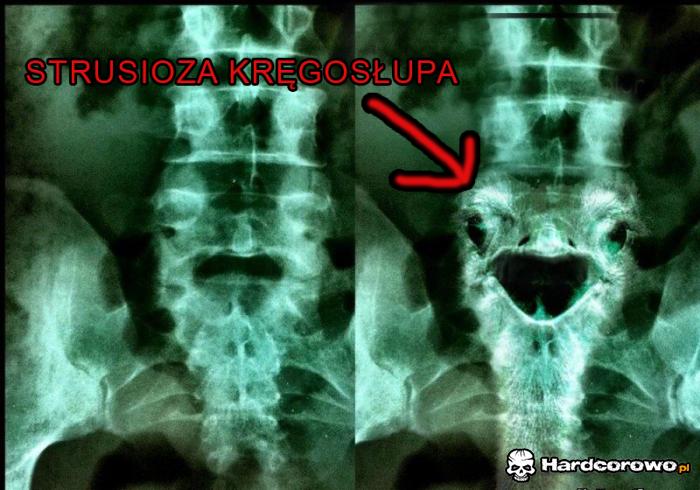 Diagnoza - 1
