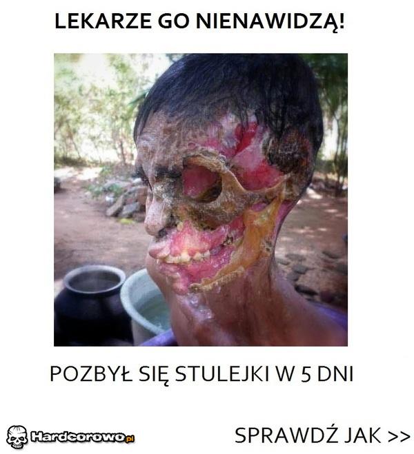 Sposób - 1