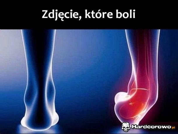 Ból od samego patrzenia - 1