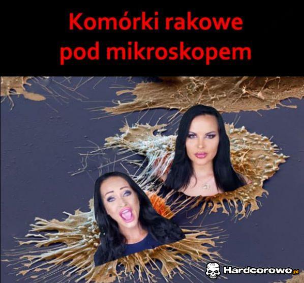 Komórki rakowe - 1