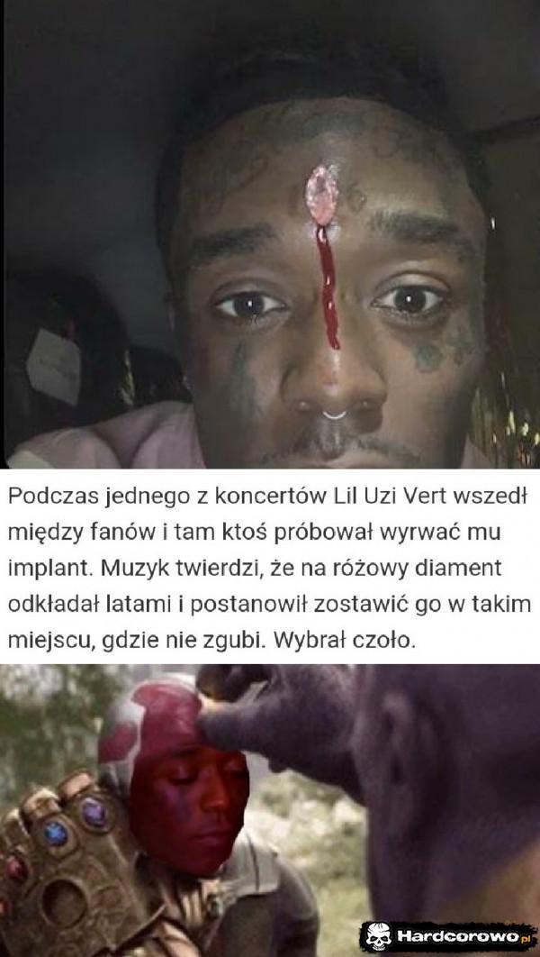  - 1