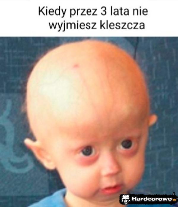  - 1