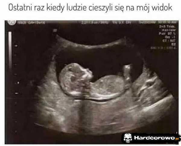  - 1